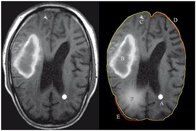 Survey of Image Processing Techniques for Brain Pathology Diagnosis: Challenges and Opportunities
